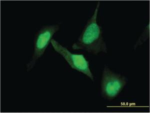 Anti-DPYSL2 Mouse Monoclonal Antibody [clone: 1F11]