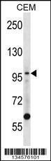 Anti-LIG1 Rabbit Polyclonal Antibody (APC (Allophycocyanin))