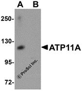 Western blot analysis of ATP11A in K562 cell tissue lysate with ATP11A antibody at 1 &#956;g/mL in (A) the absence and (B) the presence of blocking peptide.