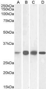 Anti-KHK Antibody (A82990) (0.03µg/ml) staining of Human (A), Mouse (B), Rat (C) and Pig (D) Liver lysates (35µg protein in RIPA buffer). Primary incubation was 1 hour. Detected by chemiluminescence.