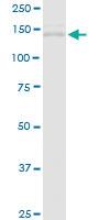 Anti-tim Rabbit Polyclonal Antibody