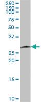 Anti-SPC25 Mouse Polyclonal Antibody