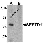 Western blot analysis of SESTD1 in rat brain tissue lysate with SESTD1 antibody at 1 &#956;g/mL in (A) the absence and (B) the presence of blocking peptide.