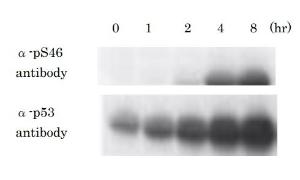 Anti-p53 (phospho Ser46) Antibod