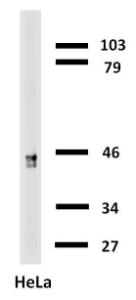 Western blotting analysis of cytokeratin 18 in HeLa cells with Anti-Cytokeratin 18 Antibody (A86659)