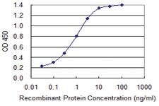 Anti-DPYSL2 Mouse Monoclonal Antibody [clone: 1F11]