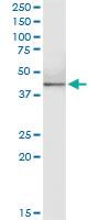 Anti-HDAC11 Rabbit Polyclonal Antibody