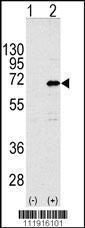 Anti-CNOT4 Rabbit Polyclonal Antibody