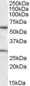 Anti-KCNQ1 Antibody (A82991) (1 µg/ml) staining of Human Heart lysate (35 µg protein in RIPA buffer). Primary incubation was 1 hour. Detected by chemilu minescence