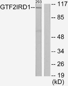 Western blot analysis of lysates from 293 cells using Anti-GTF2IRD1 Antibody. The right hand lane represents a negative control, where the antibody is blocked by the immunising peptide