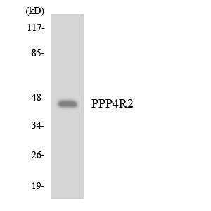 Anti-PPP4R2 antibody