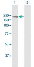 Anti-tim Rabbit Polyclonal Antibody