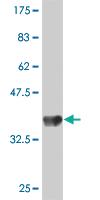 Anti-TRIM58 Mouse Polyclonal Antibody