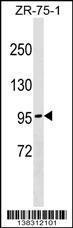 Anti-NDST4 Rabbit Polyclonal Antibody (FITC (Fluorescein Isothiocyanate))