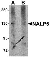 Western blot analysis of NALP5 in mouse brain tissue lysate with NALP5 antibody at 1 &#956;g/mL in (A) the absence and (B) the presence of blocking peptide.