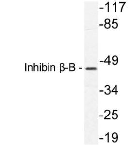 Western blot analysis of lysate from HeLa cells using Anti-Inhibin beta-B Antibody