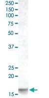 Anti-PMAIP1 Goat Polyclonal Antibody