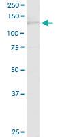 Anti-tim Rabbit Polyclonal Antibody