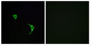 Immunofluorescence analysis of LOVO cells using Anti-SAPK Antibody. The right hand panel represents a negative control, where the antibody was pre-incubated with the immunising peptide.