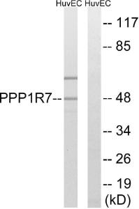 Western blot analysis of lysates from HUVEC cells using Anti-PPP1R7 Antibody. The right hand lane represents a negative control, where the antibody is blocked by the immunising peptide