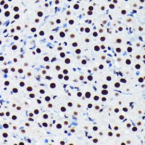 Immunohistochemistry analysis of paraffin-embedded rat ovary using Anti-TDP43 Antibody [ARC0492] (A306079) at a dilution of 1:100 (40x lens). Perform microwave antigen retrieval with 10 mM PBS buffer pH 7.2 before commencing with IHC staining protocol.