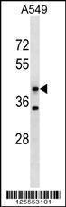 Anti-MFSD5 Rabbit Polyclonal Antibody (FITC (Fluorescein Isothiocyanate))