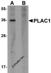 Western blot analysis of PLAC1 in human placenta tissue lysate with PLAC1 antibody at 1 &#956;g/mL in (A) the absence and (B) the presence of blocking peptide.