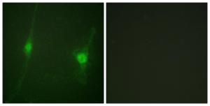 Immunofluorescence analysis of NIH/3T3 cells using Anti-LKB1 Antibody. The right hand panel represents a negative control, where the Antibody was pre-incubated with the immunising peptide