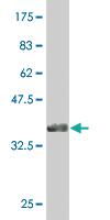 Anti-CAND1 Mouse Monoclonal Antibody [clone: 4D10]