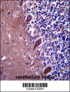 Anti-TTC13 Rabbit Polyclonal Antibody (Biotin)