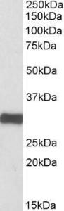 Antibody anti-ETFA A82993-100 100 µg