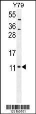 Anti-NDUAB Rabbit Polyclonal Antibody (AP (Alkaline Phosphatase))