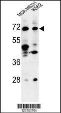 Anti-TSPEAR Rabbit Polyclonal Antibody (AP (Alkaline Phosphatase))