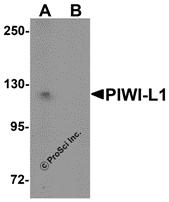 Western blot analysis of PIWI-L1 in HepG2 cell lysate with PIWI-L1 antibody at 1 &#956;g/mL in (A) the absence and (B) the presence of blocking peptide.