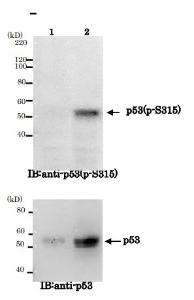 Anti-p53 (phospho Ser315) Antibody