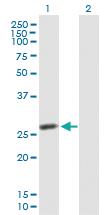 Anti-IDI2 Mouse Polyclonal Antibody