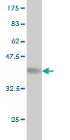 Anti-PEAK1 Mouse Monoclonal Antibody [clone: 3E7]