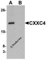 Western blot analysis of CXXC4 in human brain tissue lysate with CXXC4 antibody at 1 &#956;g/mL in (A) the absence and (B) the presence of blocking peptide.