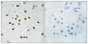 Immunohistochemical analysis of paraffin-embedded human brain tissue using Anti-KLF10 + KLF11 Antibody. The right hand panel represents a negative control, where the antibody was pre-incubated with the immunising peptide