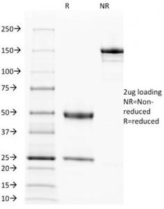 Antibody anti-EGFR 31G7 bsid 100 µg