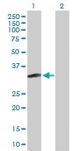 Anti-MAGEH1 Rabbit Polyclonal Antibody