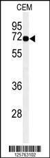 Anti-MFSD6 Rabbit Polyclonal Antibody (AP (Alkaline Phosphatase))