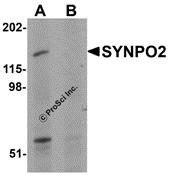 Western blot analysis of SYNPO2 in human skeletal muscle tissue lysate with SYNPO2 antibody at 1 &#956;g/mL in (A) the absence and (B) the presence of blocking peptide.