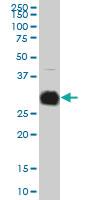 Anti-KLK10 Mouse Monoclonal Antibody [clone: 1G8]