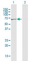 Anti-POLR3C Rabbit Polyclonal Antibody