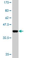 Anti-CAND1 Mouse Monoclonal Antibody [clone: 1G5]