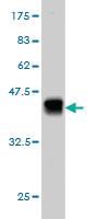 Anti-PEAK1 Mouse Monoclonal Antibody [clone: 3G6]