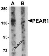 Western blot analysis of PEAR1 in rat kidney tissue lysate with PEAR1 antibody at 1 &#956;g/mL in (A) the absence and (B) the presence of blocking peptide.