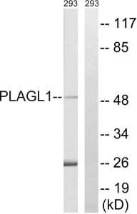 Western blot analysis of lysates from 293 cells using Anti-PLAGL1 Antibody. The right hand lane represents a negative control, where the antibody is blocked by the immunising peptide