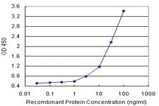 Anti-GAK Polyclonal Antibody Pair